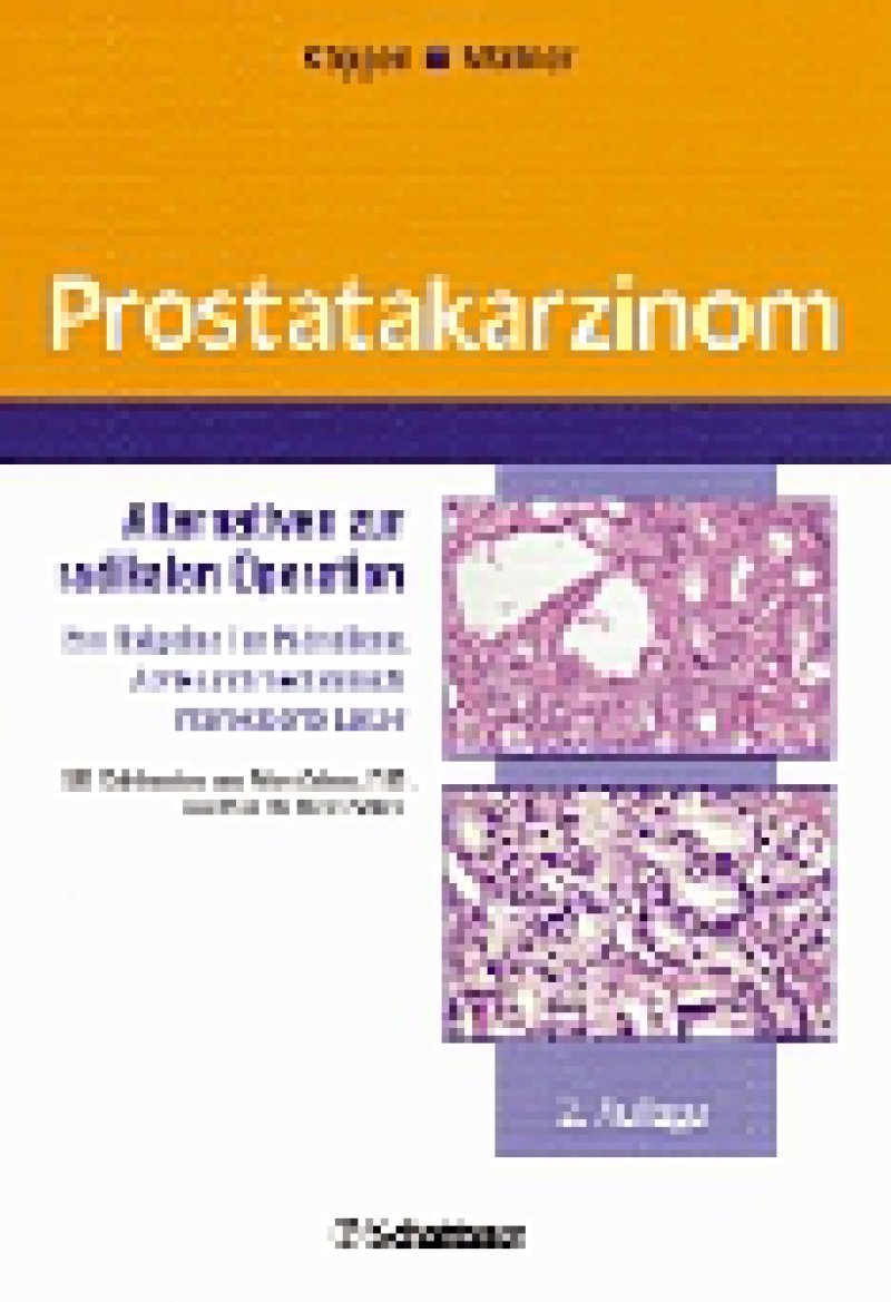 Prostatakarzinom