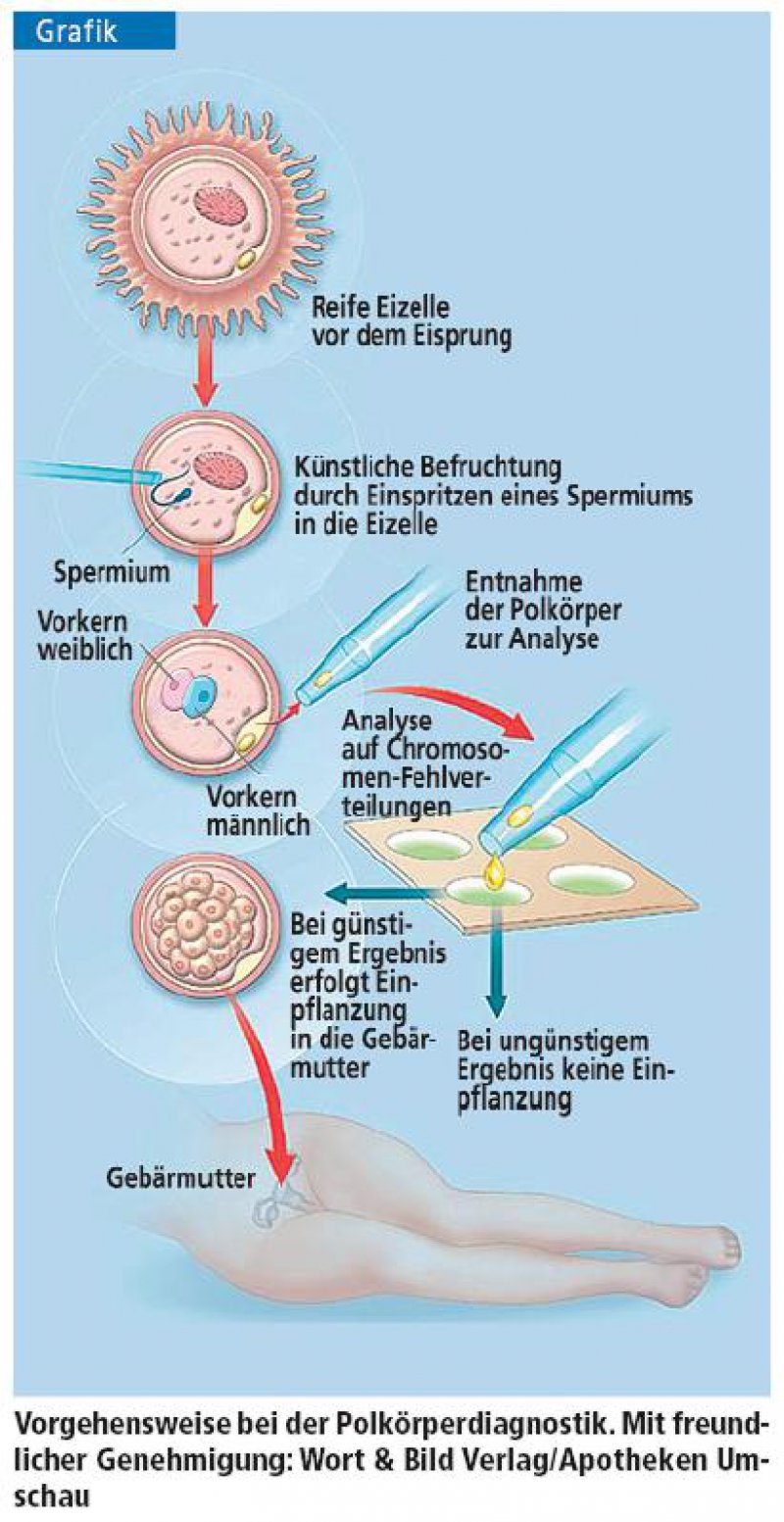 Neue Entwicklungen In Der Reproduktionsmedizin