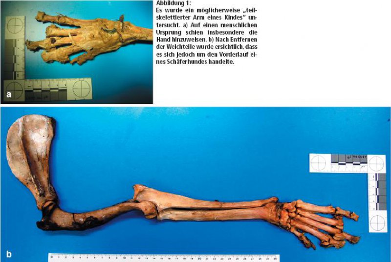 Forensische Anthropologie Und Osteologie Ubersicht Und Definitionen