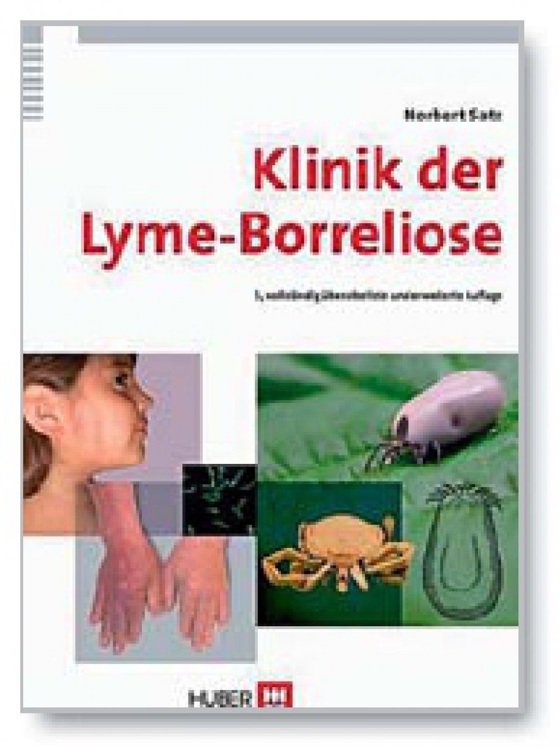 Lyme Borreliose Nützliche Informationen 8316