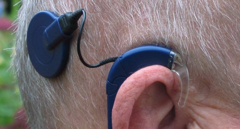 App Unterstutzt Patienten Mit Cochlea Implantat