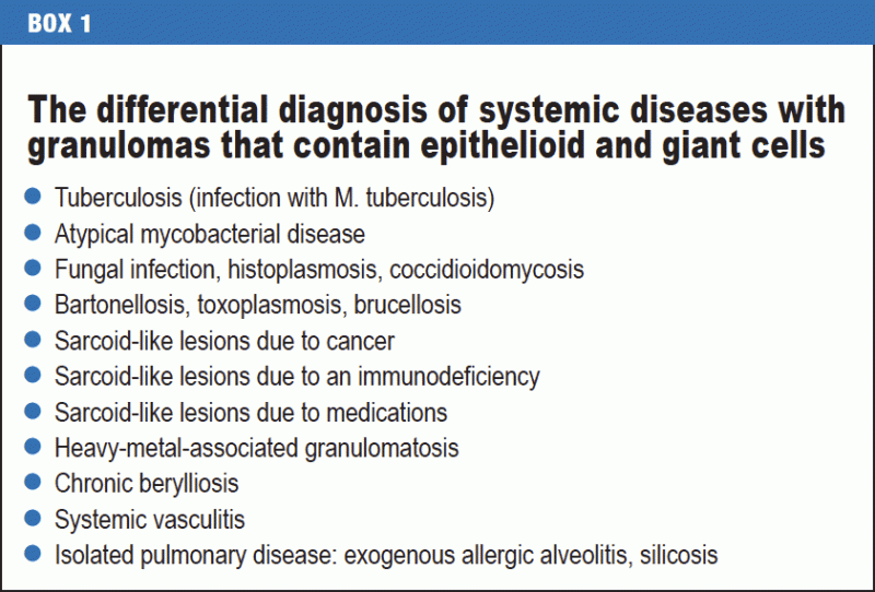 The Diagnosis Differential Diagnosis And Treatment Of Sarcoidosis 22 08 2016