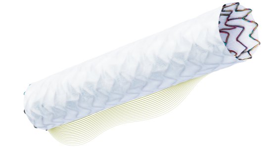 Notfallperforation: Stent mit Folie kann Koronarien abdichten