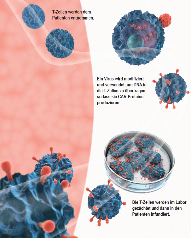 CAR-T-Zelltherapie: Neuland: Wie Man „lebende“ Arzneimittel Bewertet