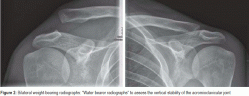 Radiografie bilaterali in carico: 