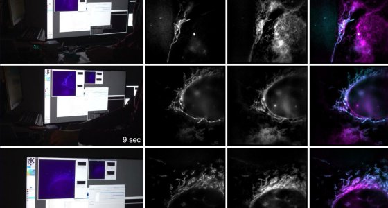 Aufnahmen des neuen Mikroskops: Der Computerbildschirm und die Mikroskopbilder (rechts) zeigen eine Knochenkrebszelle mit Mitochondrien (blau) und endoplasmatischem Retikulum (rosa)./Universität Bielefeld, W. Hübner