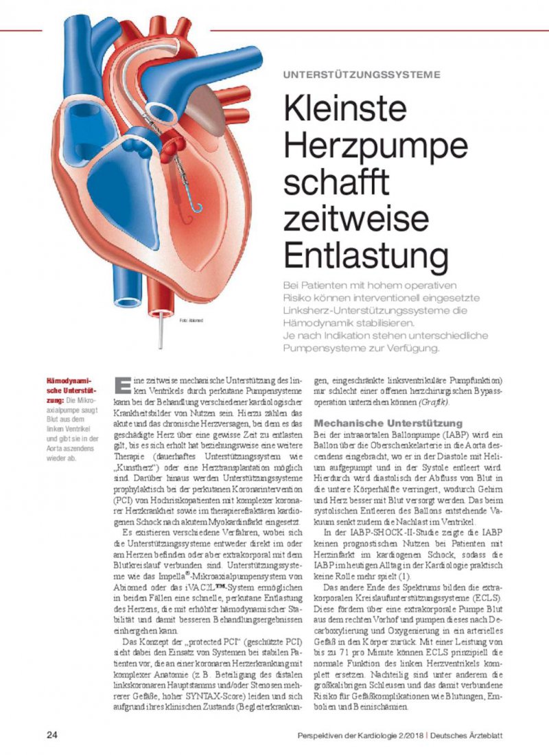 Unterstutzungssysteme Kleinste Herzpumpe Schafft Zeitweise Entlastung